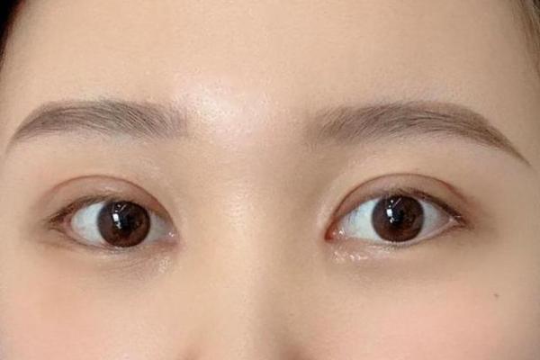 割双眼皮的命理影响：误区还是命运的转折点？