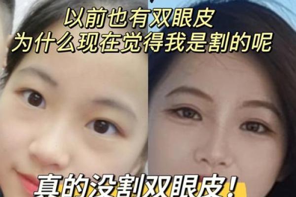 割双眼皮的命理影响：误区还是命运的转折点？
